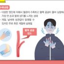 수족냉증 원인 증상 치료 이미지