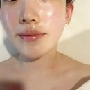 수블랑에스테틱