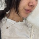 성신여대피부과 쥬베룩+포텐자+LDM 솔직 내돈내산 후기 여행 후 꿀피부 복구 성공