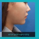 베스트실루엣 이미지