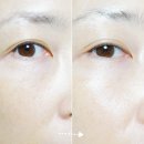 기미잡티 화장품 디어글렘 트라넥삼산세럼 선택 이유 후기