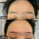 아나덴슈가링왁싱 대구상인점 | 대구 슈가링 왁싱 '에이블 슈가링왁싱&amp;루나라 대구상인센터' 눈썹 왁싱+ 인중 왁싱 후기