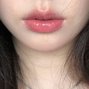 홍대피부과 입술필러 발품팔아 다녀온 후기