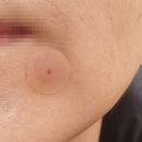 관저드림의원 네이버블로그