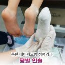 드림정형외과의원 | 평발 인솔과 기성 깔창의 차이 3가지, 아이 발에 맞는 기준