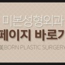 미본 이미지