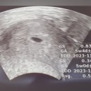 다나한의원 | 두 번 연속 계류 유산 소파술, 반복유산 검사 후기