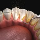 디데이치과의원 이미지