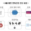 뇌졸중 후 연하장애 '이것' 하나로 진단 이미지