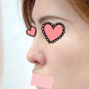 예롬성형외과 네이버블로그