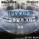 이종석치과의원 | [치아교정] 교정으로 유명한 고우넷치과 상담후기(치아교정치과추천)