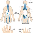 체했을 때 손 따는 방법 이미지