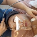 세리영 스킨케어 | [ 중화역피부관리 ] 세리영스킨케어 LDM물방울리프팅 후기 효과