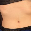 최프로 스킨 앤 바디 이미지