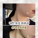 유성 | 이중턱 때문에 알아본 대전 유성 피부과 상담 후기