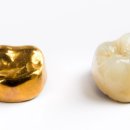 골드크라운 이미지