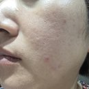 수분에센스 추천! 코아주 디아쥬 아줄렌 토닝 에센스로 피부장벽 케어한 후기