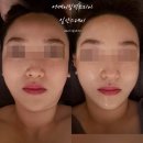 F110 페이스 스몰 테크닉 80분 솔직 후기 (3D스캔+인바디+1인실 관리) 일산 피부관리