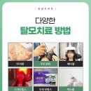 성지 | 부산탈모성지, 후기만 믿었다가 실패하는 3가지