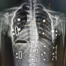 연세보조기 이미지