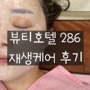 286 | [울산 북구 에스테틱] 뷰티호텔 286 재생케어 후기(모낭충 주의!)