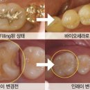 덴탈라인치과기공소 이미지