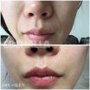 디크림슨