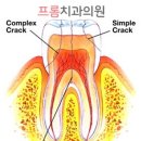 프롬치과의원 네이버블로그