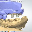 나온치과기공소 이미지