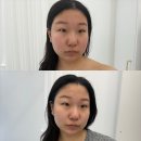 고등동 피부관리 | 올가드림뷰티 고등점 트러블케어 후기