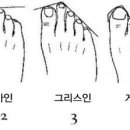베니네일