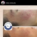 왁싱데이스킨케어 이미지