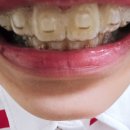 별가람소아치과의원 | 의사선생님들,간호사선생님 모두 친절한 별가람소아치과