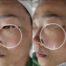 라벨라스킨케어 이미지