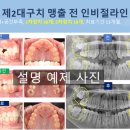 웃는E치과교정과치과의원 네이버블로그