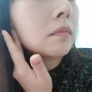 동영밴딩 네이버블로그