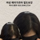 티나스칼프