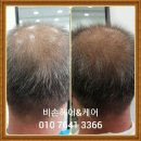 비손헤어&케어 이미지