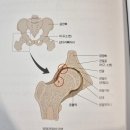 고관절 관절와순파열 후 진료 후기 whit 서울나우병원 윤필환 원장님