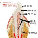 참을수 없는 치통, 밤에 더 심해지는 이유는? 이미지