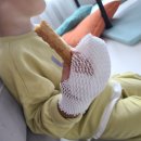 연세차오름의원 | 두돌아기 손가락 심재성2도 화상 치료 기록 진료비 / 노원화상병원