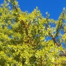 신촌연세병원 | 연세세브란스병원 신촌 조직검사 후기 (1)