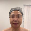진피부관리 - 천안시 서북구 월봉4로 140-16 | [부산/명지]화문에스테틱 얼굴 관리 후기 (2편) — 엄마 피부 관리까지 ✨