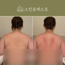 향기나는숲에스테틱향림 | [보령피부관리] 연예인도 찾는 힐링 공간, 스킨포레스트에서 제대로 관리받고 왔어요