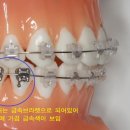 굿플란트치과의원 이미지