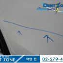 덴트존 이미지