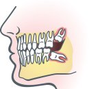 서울앤치과 이미지