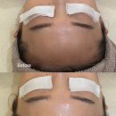 가온비스 | 천안 두정동 피부관리 아쿠아필 잘하는 곳 온비스떼 바디관리 솔직후기