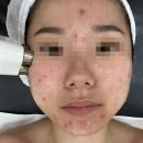 빛에스테틱 - 화순군 | [광주] 첨단 피부관리 빛,에스테틱에서 스킨케어 직접 체험 후기