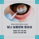 동탄에이스치과의원 | 동탄치과추천치과 서울포인트치과 앞니 임플란트를 고려하고 계신다면